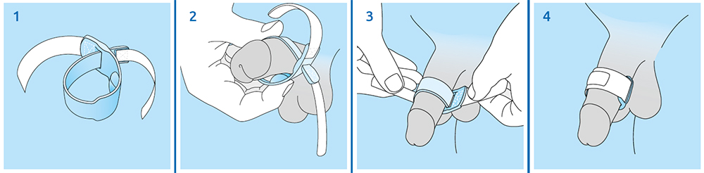 medintim Prosecca strap usage